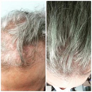 Synthetic Hair Growth Factor