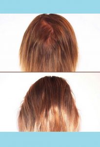 Women's Hair Growth